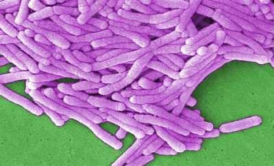 Legionella Pneumophila