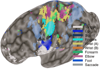 brain's motor cortex