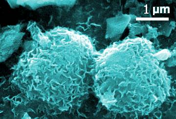 methanogens