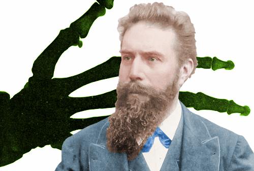 ROENTGEN